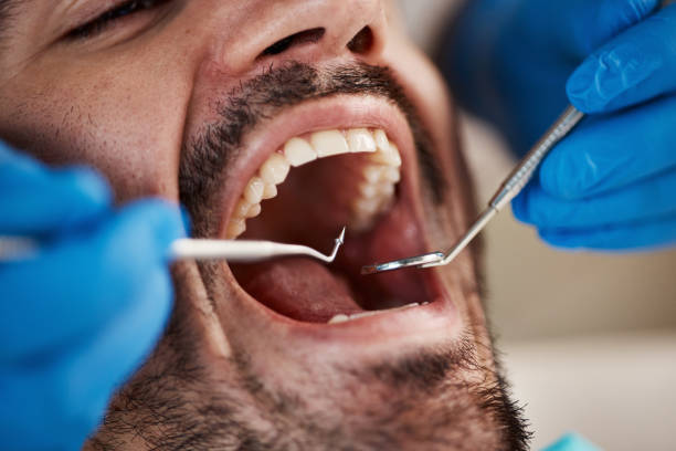 Best Broken or Cracked Tooth Emergency Dentist in Bakerstown, PA